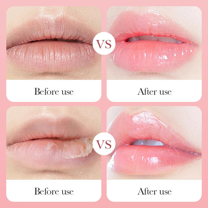 SADOER Fruits Moisturizing Lip Mask Lips Skin Care Nourishing Hydrating Crystal Collagen Gel Lip Patches Lips Plumper