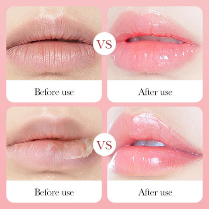 SADOER Fruits Moisturizing Lip Mask Lips Skin Care Nourishing Hydrating Crystal Collagen Gel Lip Patches Lips Plumper