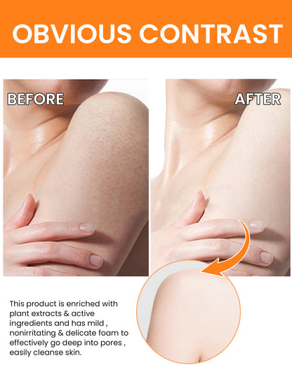 Turmeric Oil 30ml - For The Face Turmeric Serum For Dark Spots Corrector Serum For Face & Body, Anti Aging Facial Serum For Women Men, Reduces Hyperpigmentat